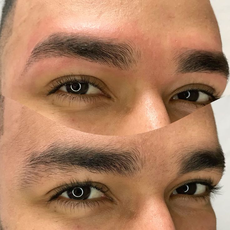 Middle of Brows (Threading) (Male)
