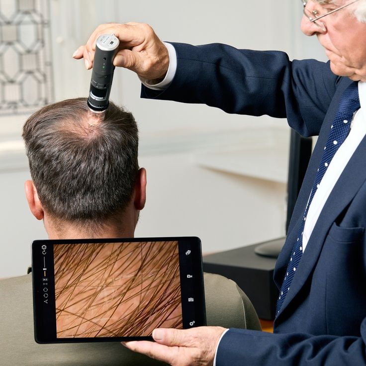 Consultation Male Hair Services (1 Yrs - 18+ )